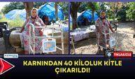 Karnından 40 Kiloluk Kitle Çıkarıldı!