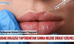 DUDAK DOLGUSU YAPTIRDIKTAN SONRA NELERE DİKKAT EDİLMELİ?