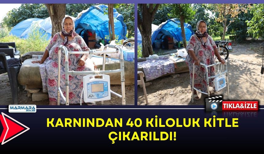 Karnından 40 Kiloluk Kitle Çıkarıldı!