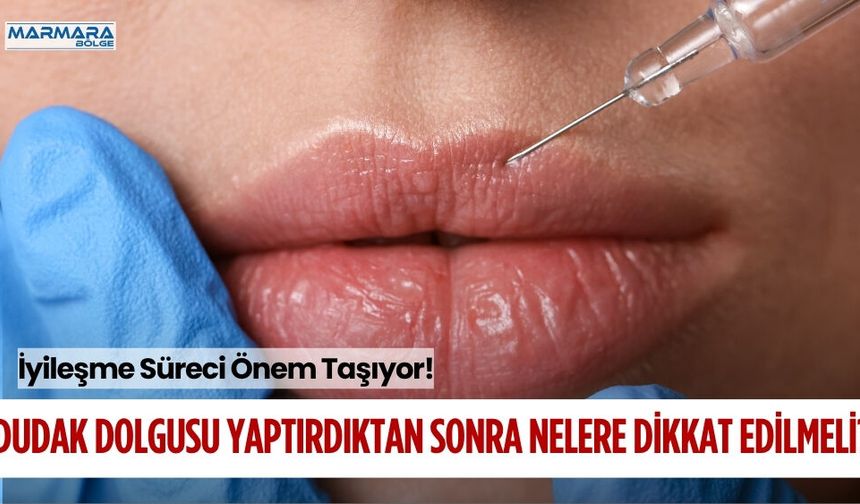 DUDAK DOLGUSU YAPTIRDIKTAN SONRA NELERE DİKKAT EDİLMELİ?